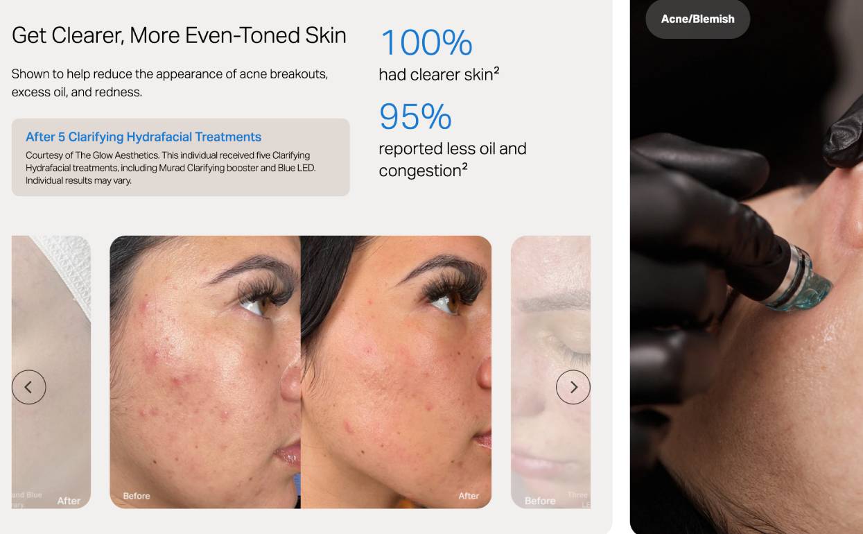 Clear Up Your Complexion