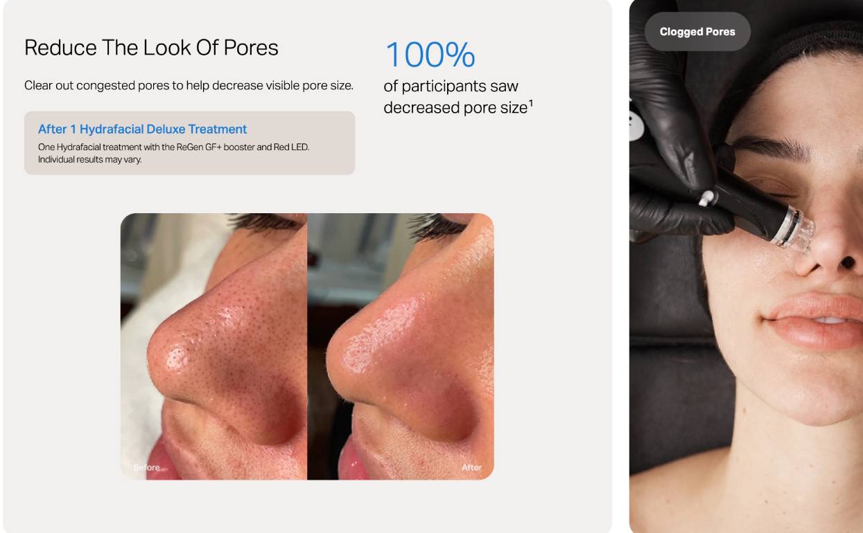 Shrink The Appearance Of Pores at Nakhon Spa Bangkok