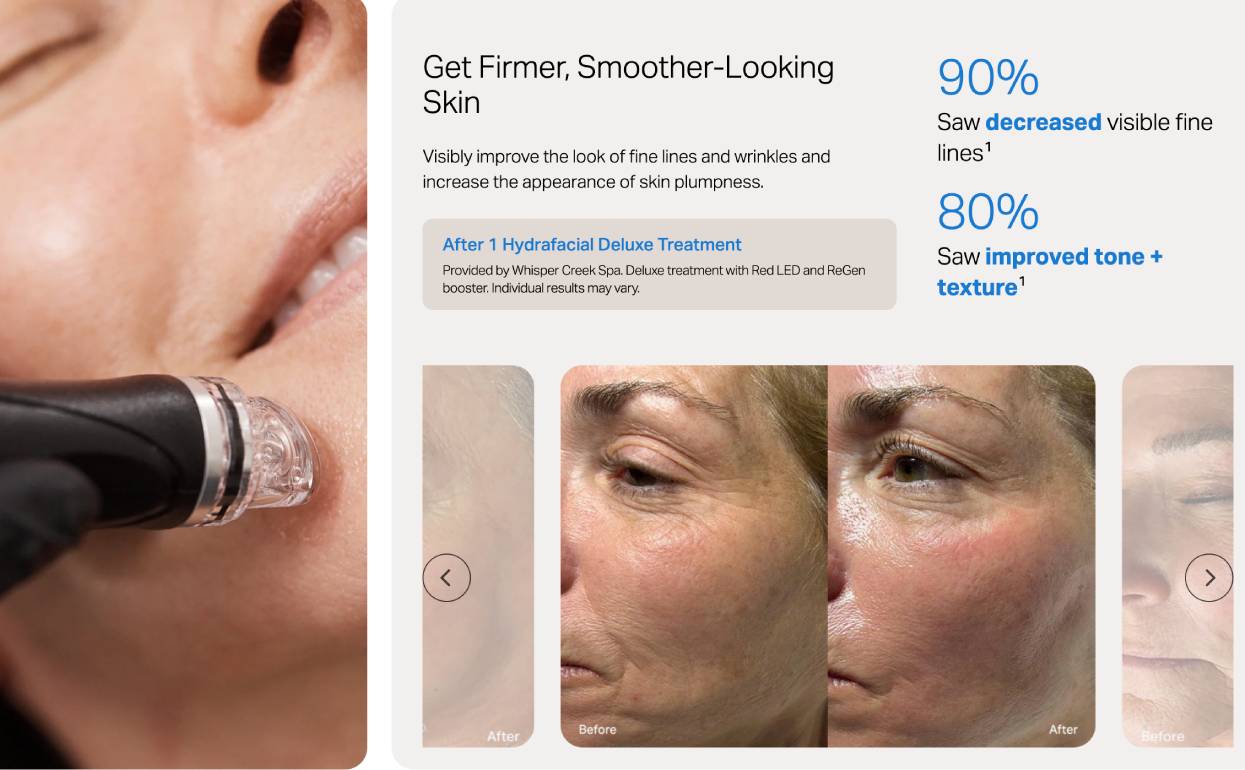 Smooth Out Fine Lines & Wrinkles
